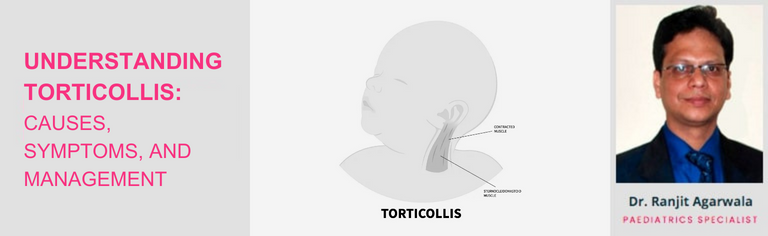 Understanding Torticollis: Causes, Symptoms, And Management by Dr. Ranjit K Agarwala – IHR India