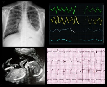 Imaging treatment in kolkata - IHR Kolkata